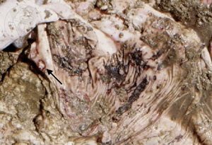 Ulcera del abomaso