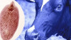 Fasciola hepatica